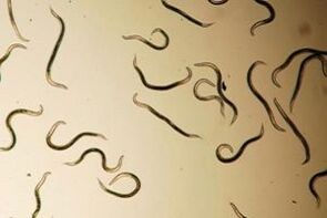 human body pinworms
