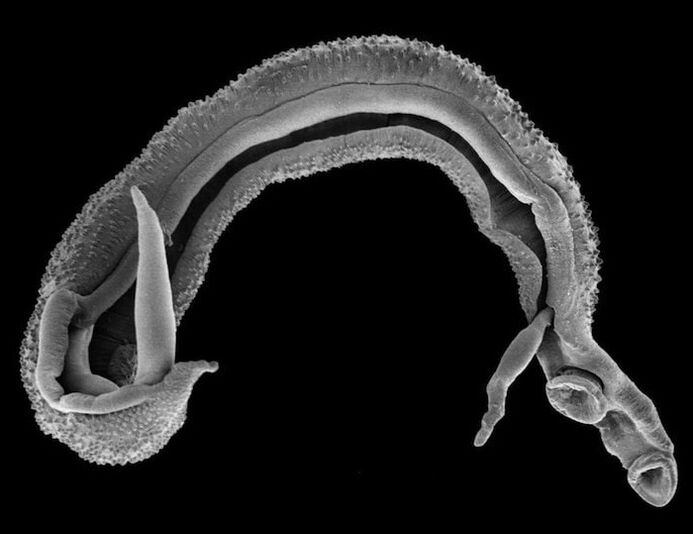 human body schistosome