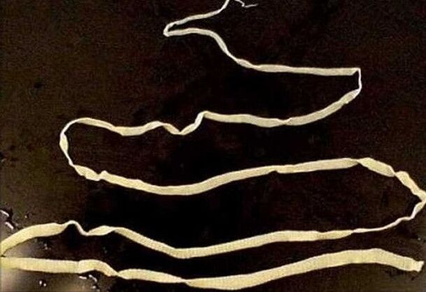 human body tapeworm