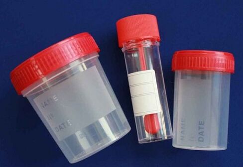 jars to test for parasites