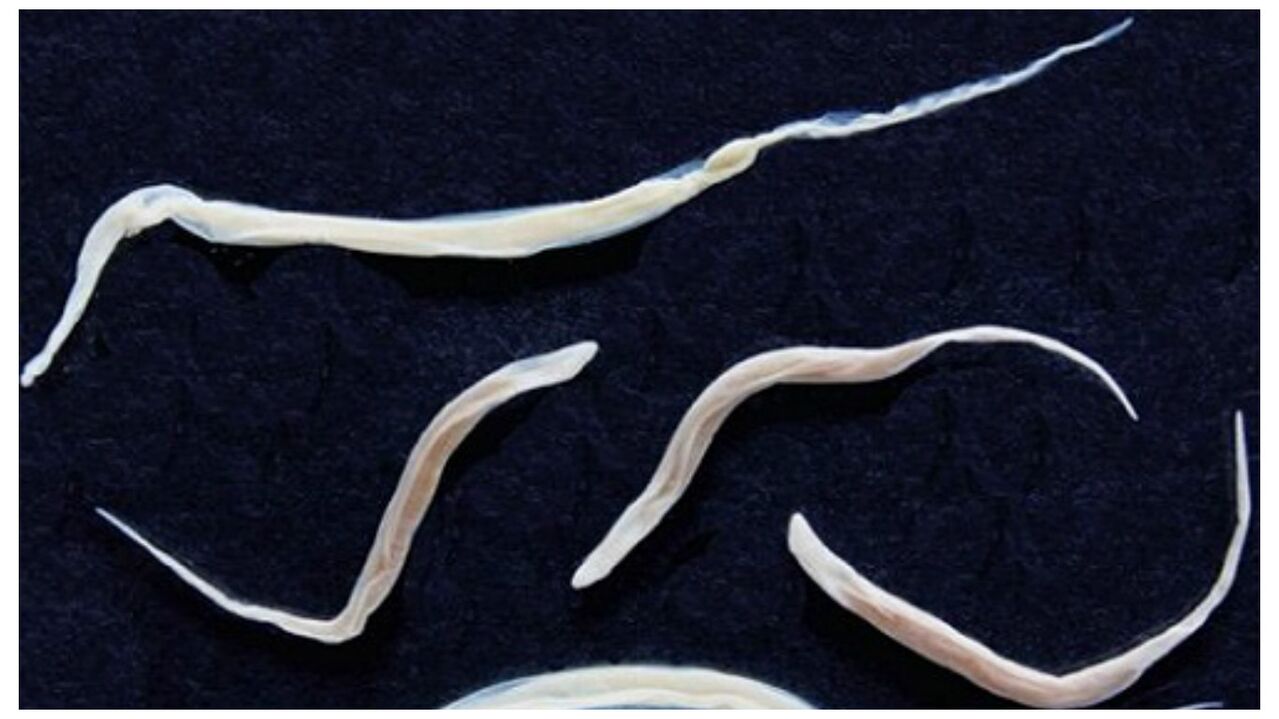 Pinworms are common parasites belonging to the helminth group.